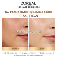Nước Hoa Hồng L'oreal paris glycolic bright peeling toner 128ml | TONER007