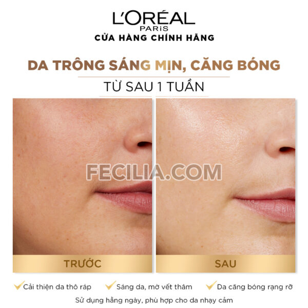 Nước Hoa Hồng L'oreal paris glycolic bright peeling toner 128ml | TONER007