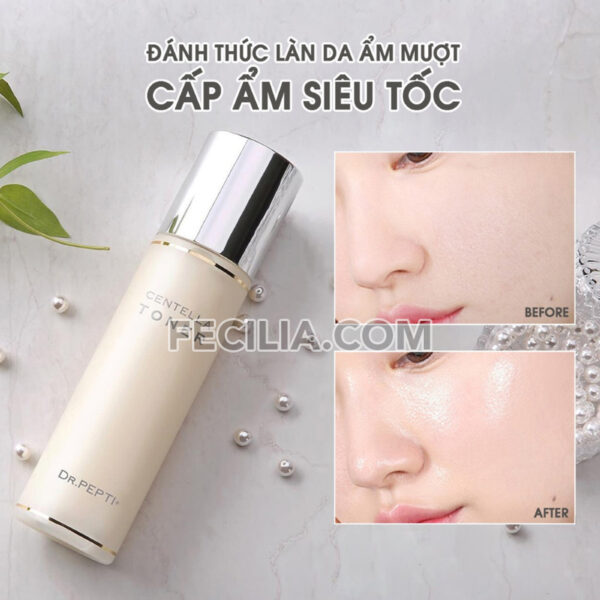 Nước Hoa Hồng Toner Dr.Pepti Centella Toner 180ml |TONER006