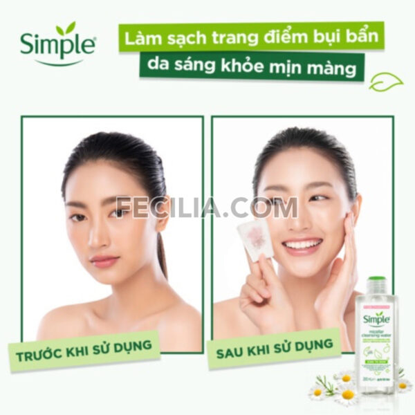 Nước Tẩy Trang và cấp ẩm Simple Micellar 200ml |NTT038