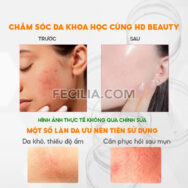Nước Tẩy Trang Jm Solution 500ml sạch sâu dịu nhẹ |NTT082