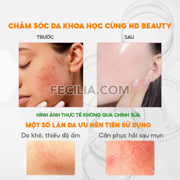 Nước Tẩy Trang Jm Solution 500ml sạch sâu dịu nhẹ |NTT082